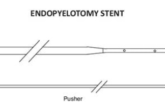 Endopyelotomy Stents in india